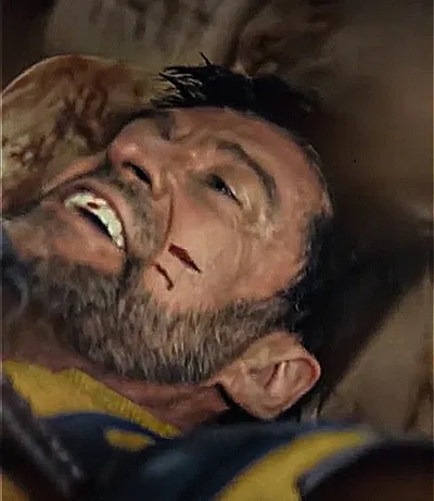 Logan Howlett | Worst Wolverine