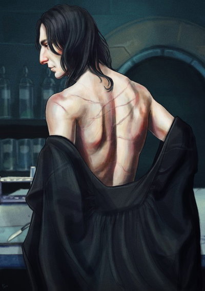 snape