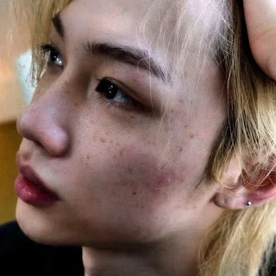 Lee Felix | Freckles