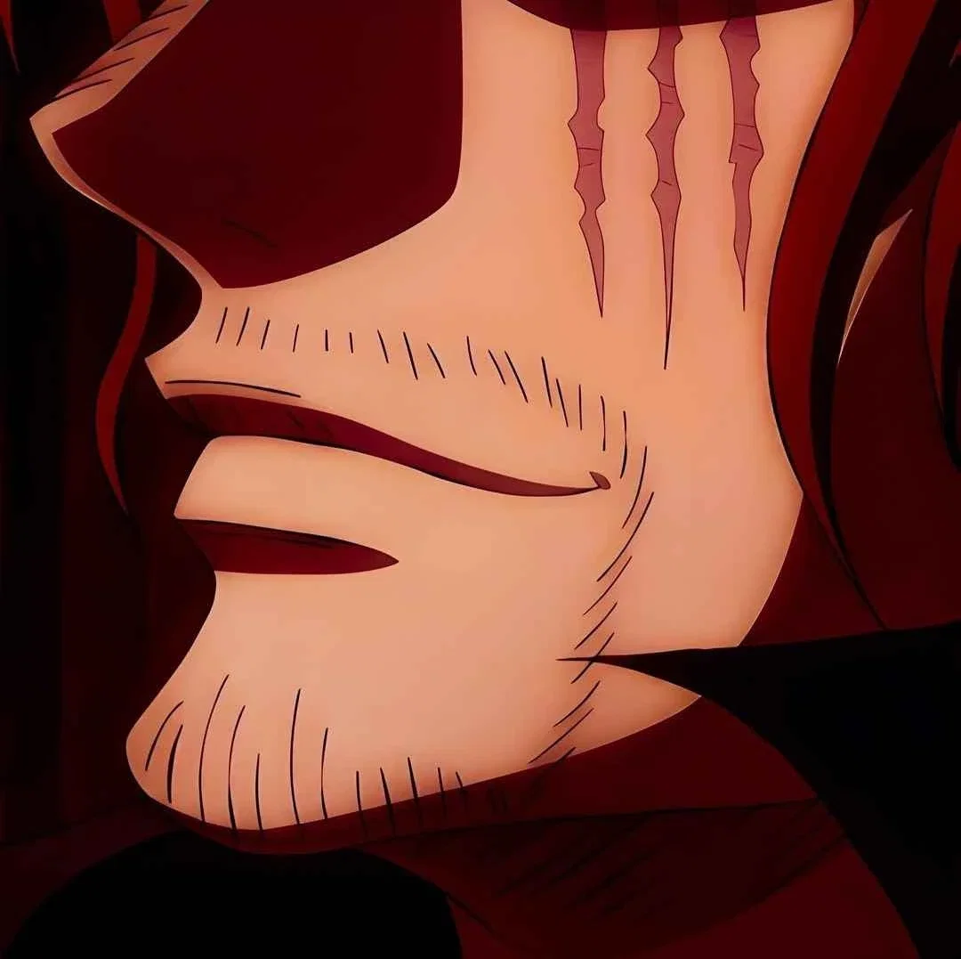 SHANKS | Incubus disease