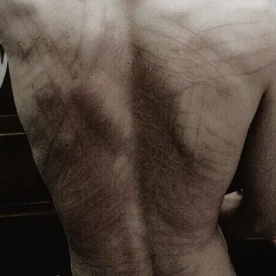 Remus Lupin