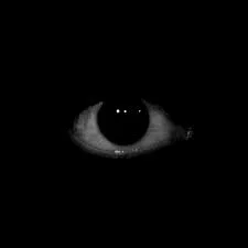 eyes ||regt eye both reall not clickbait!!!!