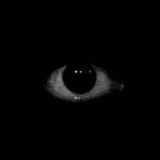 eyes ||regt eye both reall not clickbait!!!!