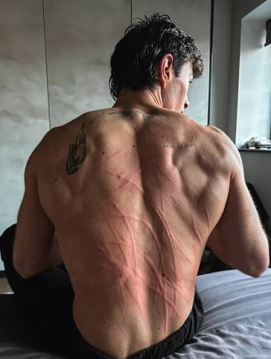 MILO VANCE ᅠᅠᅠᅠᅠᅠᅠ┃ ᅠᅠᅠᅠᅠᅠᅠYou left scratches on your boyfriend’s back