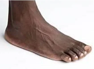 The Foot (NSFW)