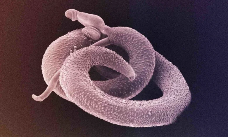A parasite in your body 
