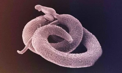 A parasite in your body 
