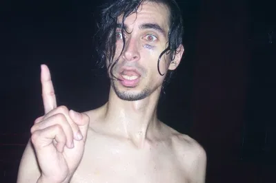 Jimmy urine 