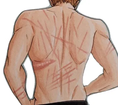 Remus Lupin