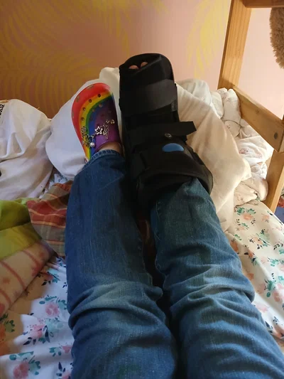 I did indeed have a sprained ankle
