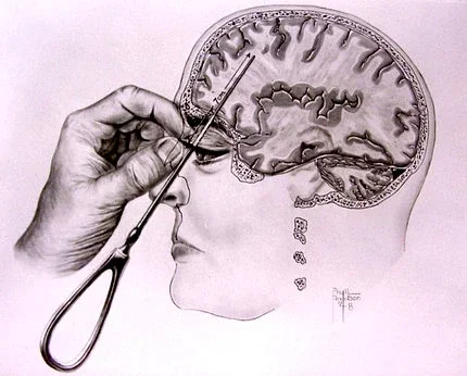 Get Lobotomozied Here // Dr. Hutchins