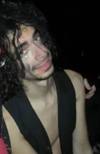 Jimmy urine 