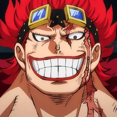 ~◇°Eustass Kid°◇~