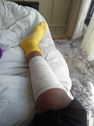 just got injured