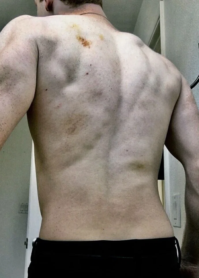 Jerome Valeska 
