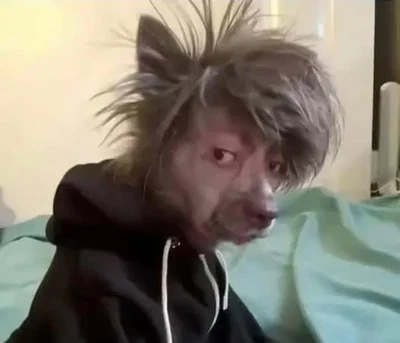 The Yappinator