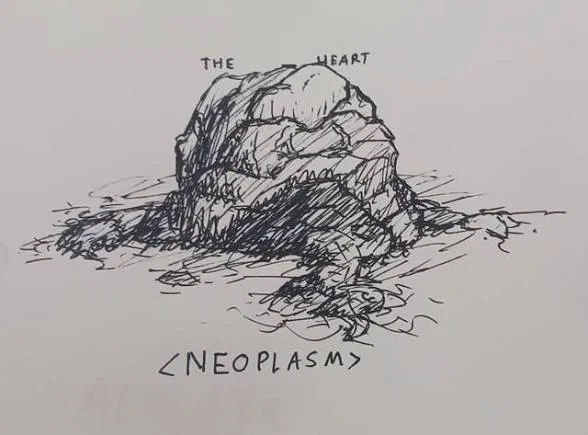 Neoplasm