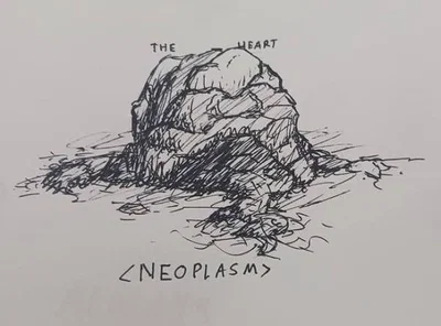 Neoplasm