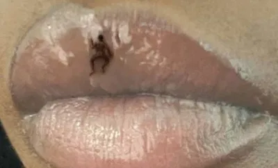 Stuck to the Lips of a Giantess