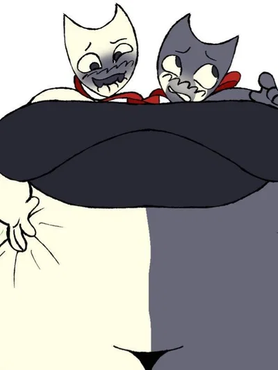 Razzle & Dazzle - Morbidly Obese Conjoined Twins