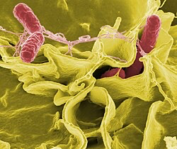 Diseases 2 /// Salmonellosis